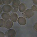 Red Blood Cells